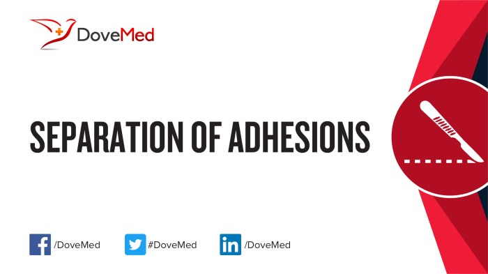 Adhesions surgical abdominal surgery abdomen stanford causes symptoms topic list therapy possible tissue prevented treated mice